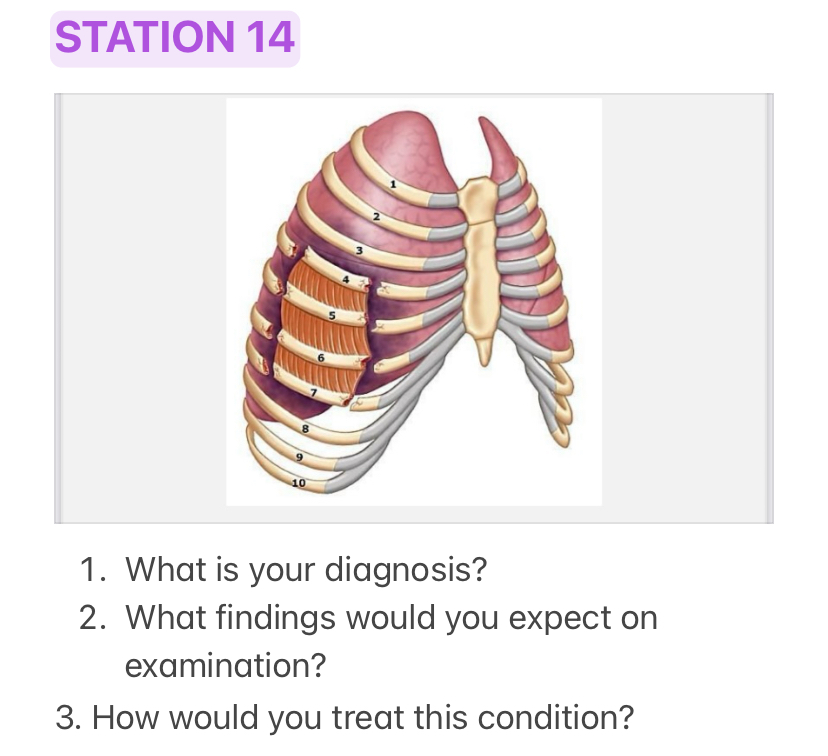 STATION 14